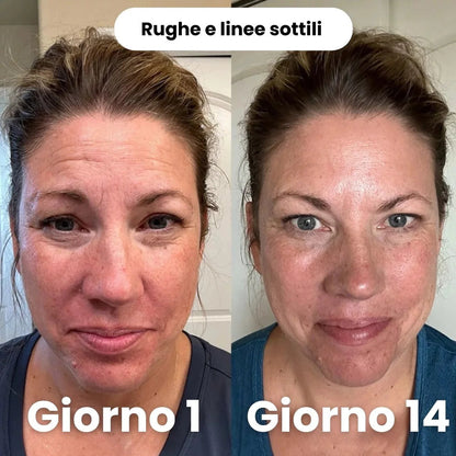 Maschera Peel-Off al Collagene