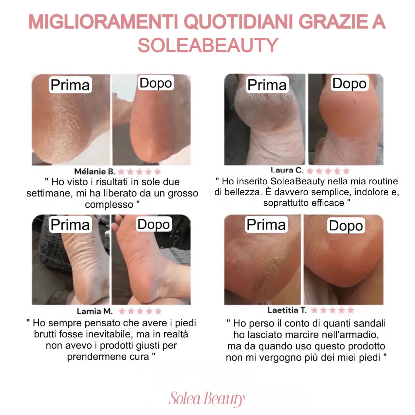Rimuovi Calli Elettrico
