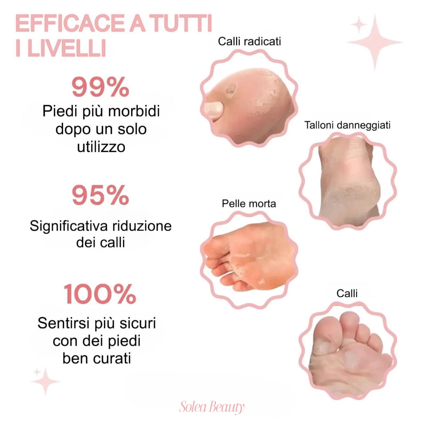 Rimuovi Calli Elettrico