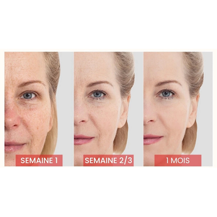 Massaggiatore Viso Ad Infrarossi