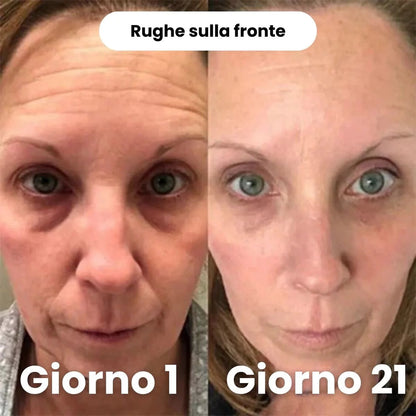 Maschera Peel-Off al Collagene
